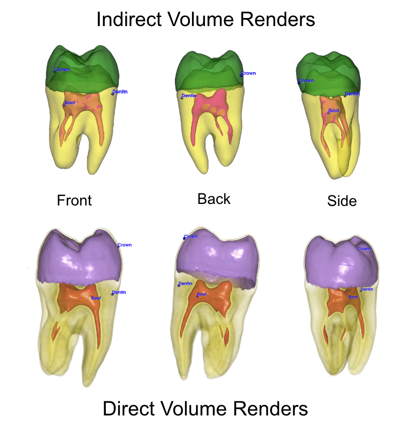 There are two rows of images of a tooth. Each row has three images. Each image is a different view of the tooth.